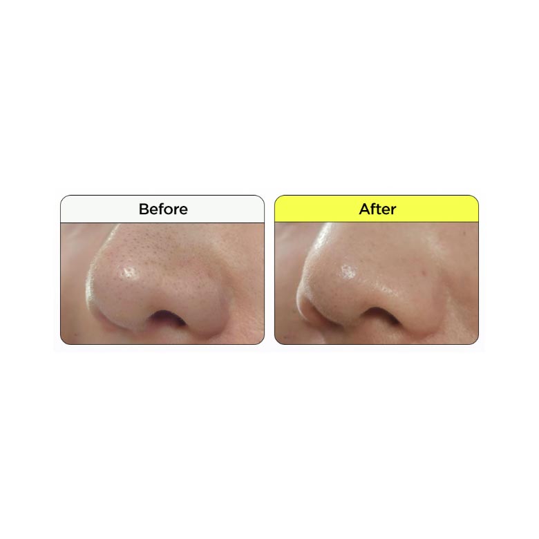 Hatherine - Pore Melting Shrinko Nose Pack (4pcs)
